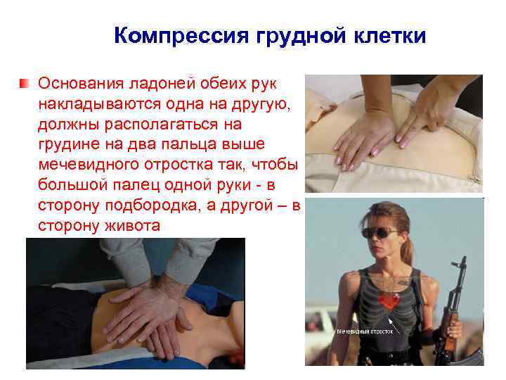 Компрессия грудной клетки Основания ладоней обеих рук накладываются одна на другую, должны располагаться на