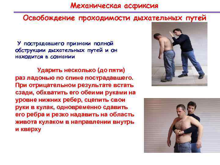 Механическая асфиксия Освобождение проходимости дыхательных путей У пострадавшего признаки полной обструкции дыхательных путей и