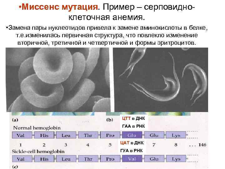  • Миссенс мутация. Пример – серповидноклеточная анемия. • Замена пары нуклеотидов привела к