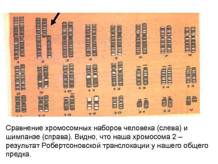 Сравнение хромосомных наборов человека (слева) и шимпанзе (справа). Видно, что наша хромосома 2 –