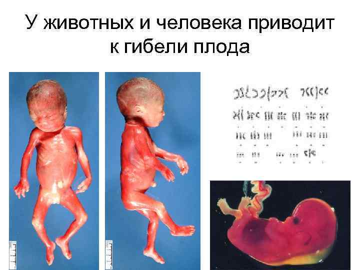 У животных и человека приводит к гибели плода 