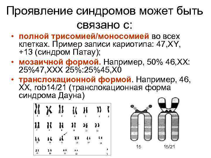 Проявление синдромов может быть связано с: • полной трисомией/моносомией во всех клетках. Пример записи