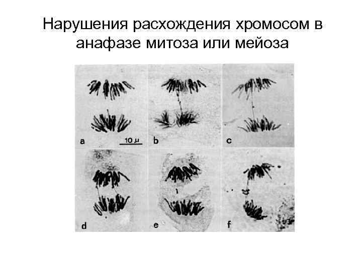 Нарушения расхождения хромосом в анафазе митоза или мейоза 