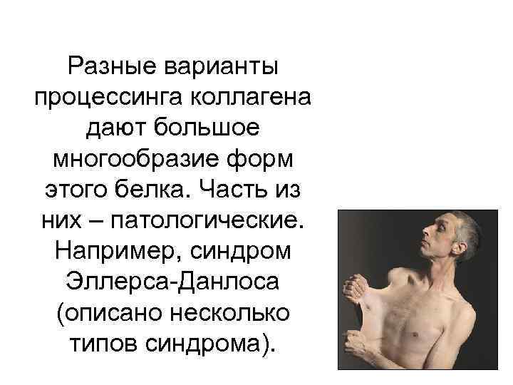 Разные варианты процессинга коллагена дают большое многообразие форм этого белка. Часть из них –