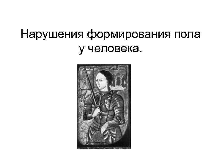 Нарушения формирования пола у человека. 