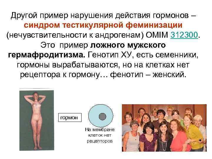 Другой пример нарушения действия гормонов – синдром тестикулярной феминизации (нечувствительности к андрогенам) OMIM 312300.