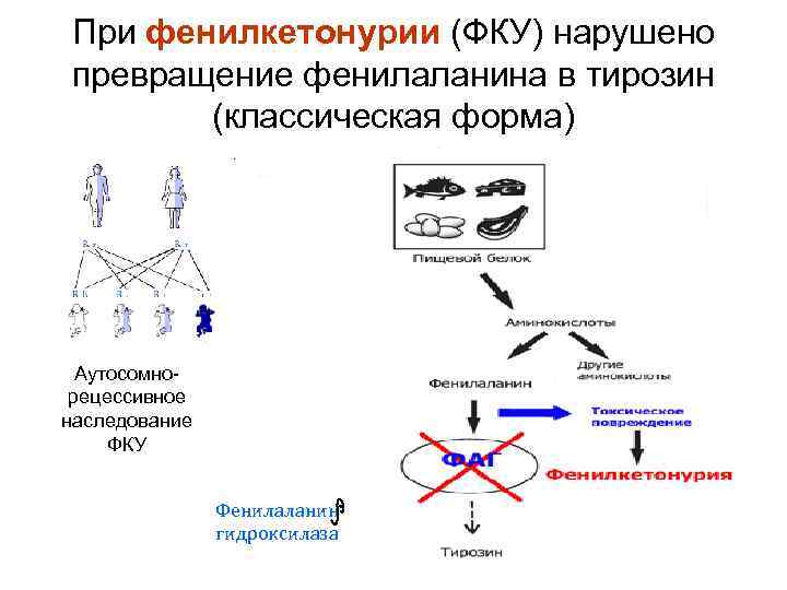 При фенилкетонурии (ФКУ) нарушено превращение фенилаланина в тирозин (классическая форма) Аутосомнорецессивное наследование ФКУ Фенилаланин
