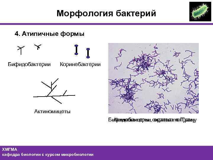Морфология бактерий 4. Атипичные формы Бифидобактерии Коринебактерии Актиномицеты Бифидобактерии, окраска по Граму Актиномицеты, окраска