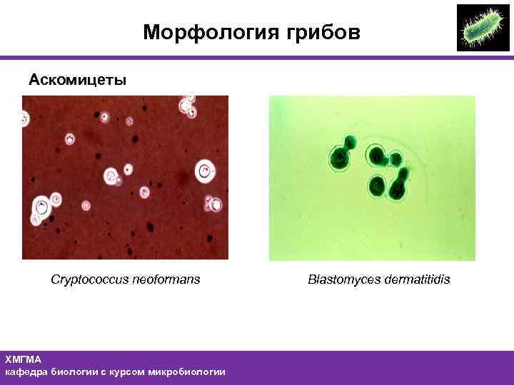 Морфология грибов Аскомицеты Cryptococcus neoformans ХМГМА кафедра биологии с курсом микробиологии Blastomyces dermatitidis 35