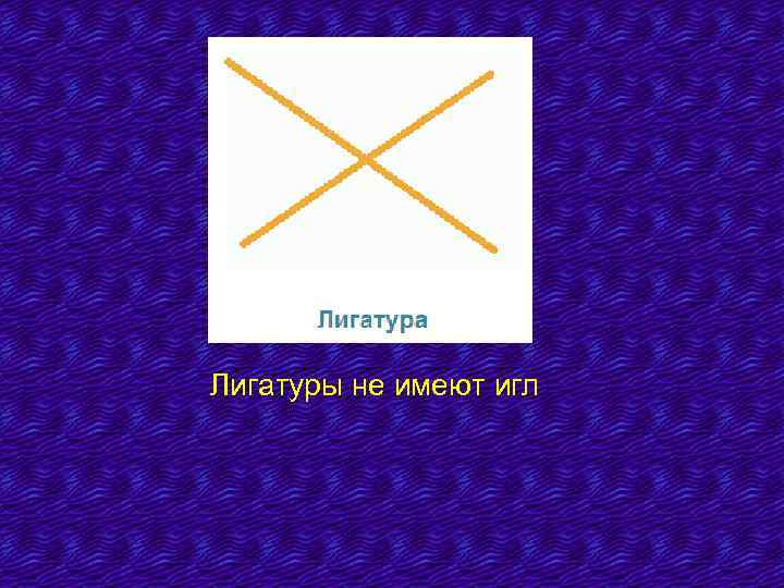 Лигатуры не имеют игл 