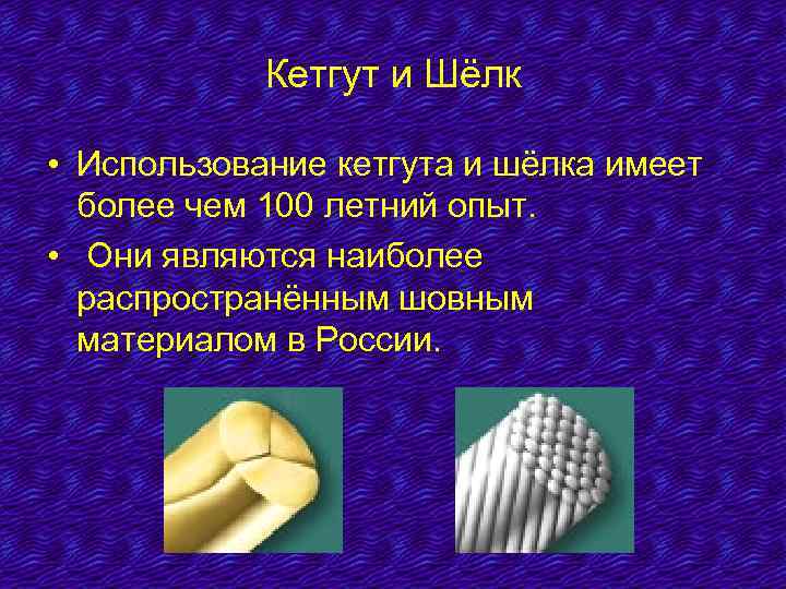 Кетгут и Шёлк • Использование кетгута и шёлка имеет более чем 100 летний опыт.