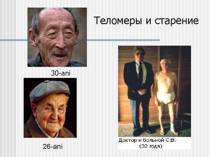 Теломеры и старение 30 -ani 26 -ani 
