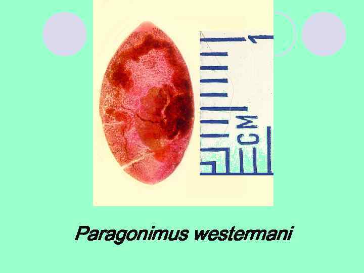 Paragonimus westermani 