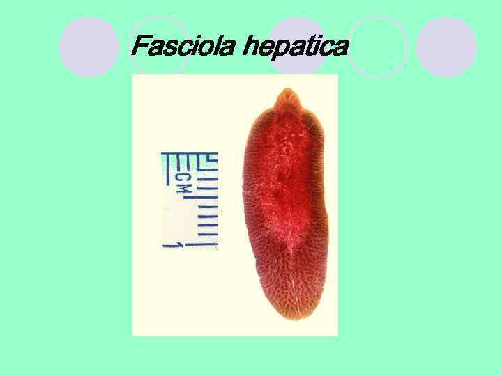 Fasciola hepatica 