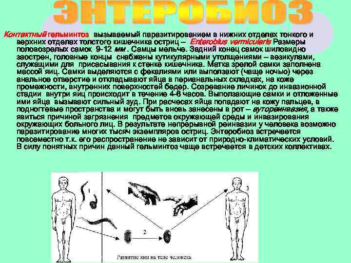 Контактный гельминтоз, вызываемый паразитированием в нижних отделах тонкого и верхних отделах толстого кишечника остриц