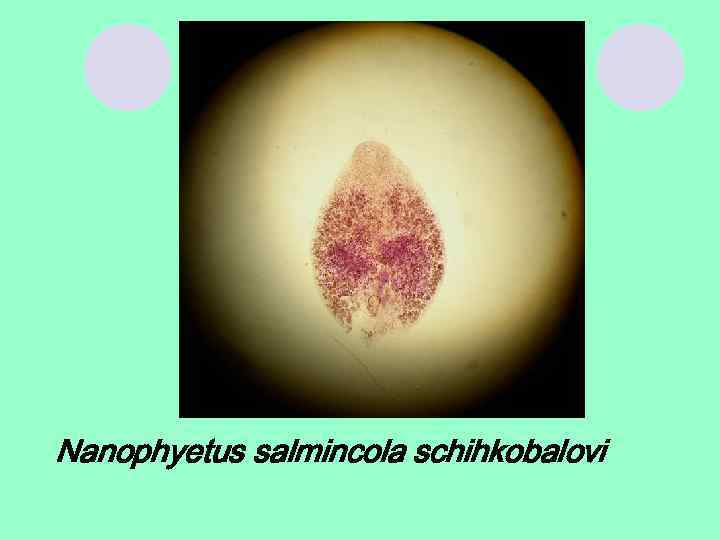 Nanophyetus salmincola schihkobalovi 