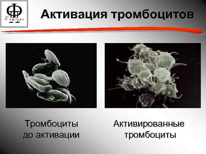 Активация тромбоцитов Тромбоциты до активации Активированные тромбоциты 