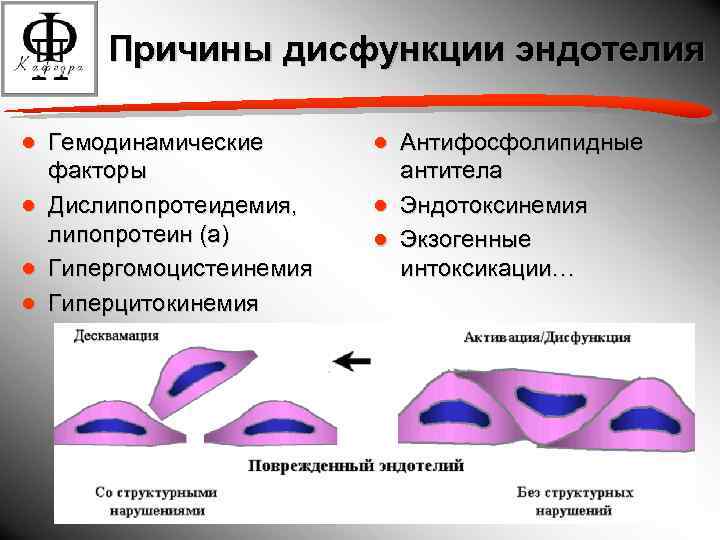 Причины дисфункции эндотелия ● Гемодинамические факторы ● Дислипопротеидемия, липопротеин (а) ● Гипергомоцистеинемия ● Гиперцитокинемия