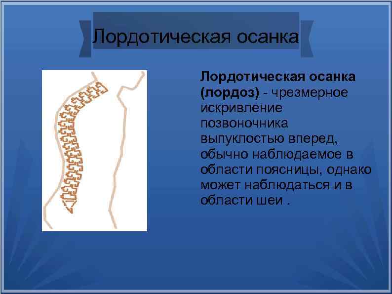 Привычное вертикальное положение