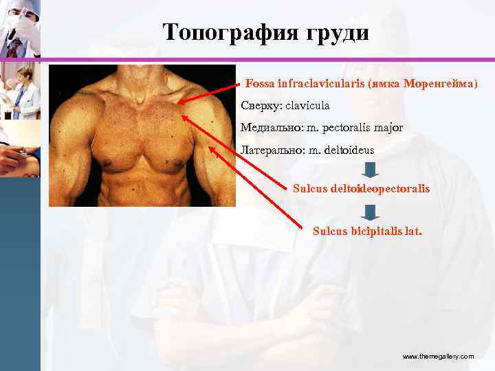 Топография груди Fossa infraclavicularis (ямка Моренгейма) Сверху: clavicula Медиально: m. pectoralis major Латерально: m.