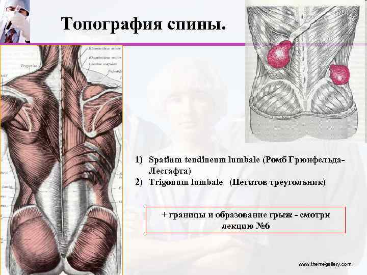 Топография спины. 1) Spatium tendineum lumbale (Ромб Грюнфельда. Лесгафта) 2) Trigonum lumbale (Петитов треугольник)