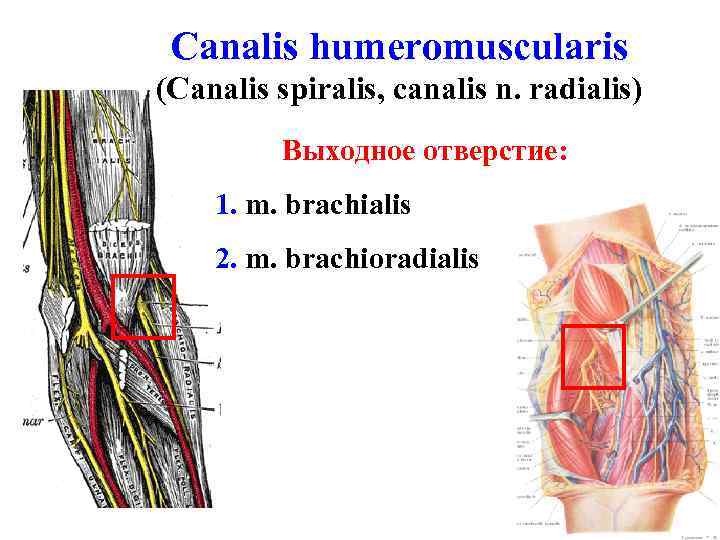 Canalis humeromuscularis (Canalis spiralis, canalis n. radialis) Выходное отверстие: 1. m. brachialis 2. m.