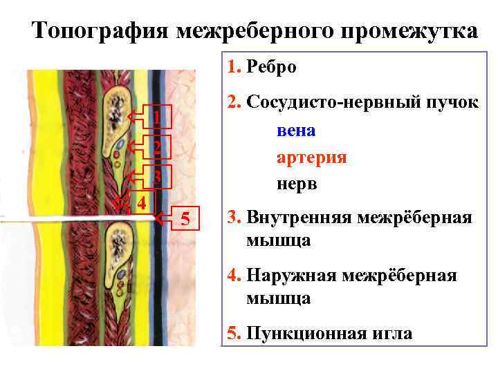 Топография межреберного промежутка 1. Ребро 2. Сосудисто-нервный пучок вена артерия нерв 1 2 3