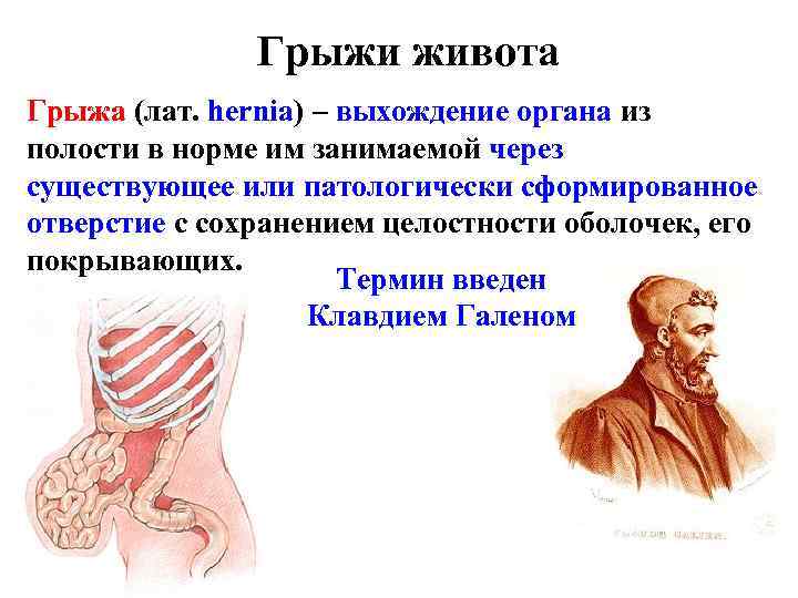 Грыжи живота Грыжа (лат. hernia) – выхождение органа из полости в норме им занимаемой