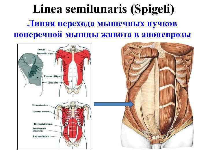 Linea semilunaris (Spigeli) Линия перехода мышечных пучков поперечной мышцы живота в апоневрозы 