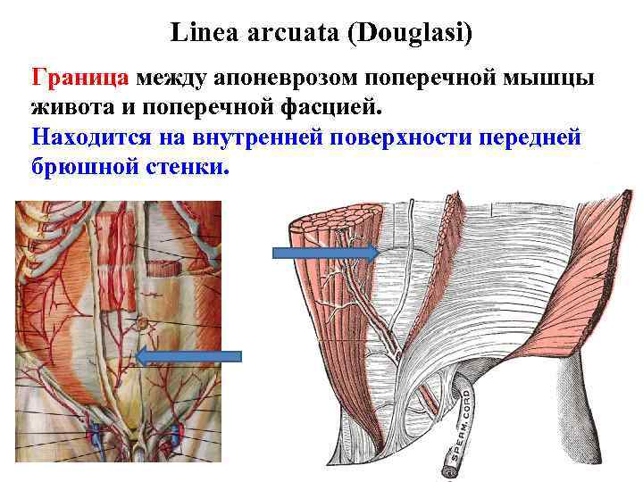 Linea arcuata (Douglasi) Граница между апоневрозом поперечной мышцы живота и поперечной фасцией. Находится на