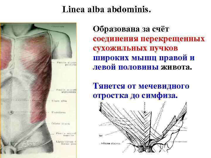 Linea alba abdominis. Образована за счёт соединения перекрещенных сухожильных пучков широких мышц правой и