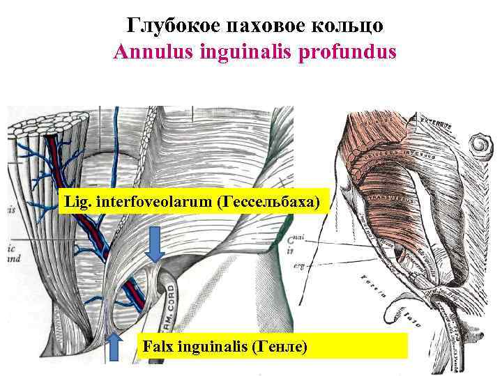 Глубокое паховое кольцо Annulus inguinalis profundus Lig. interfoveolarum (Гессельбаха) Falx inguinalis (Генле) 