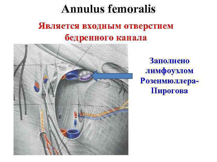 Annulus femoralis Является входным отверстием бедренного канала Заполнено лимфоузлом Розенмюллера. Пирогова 