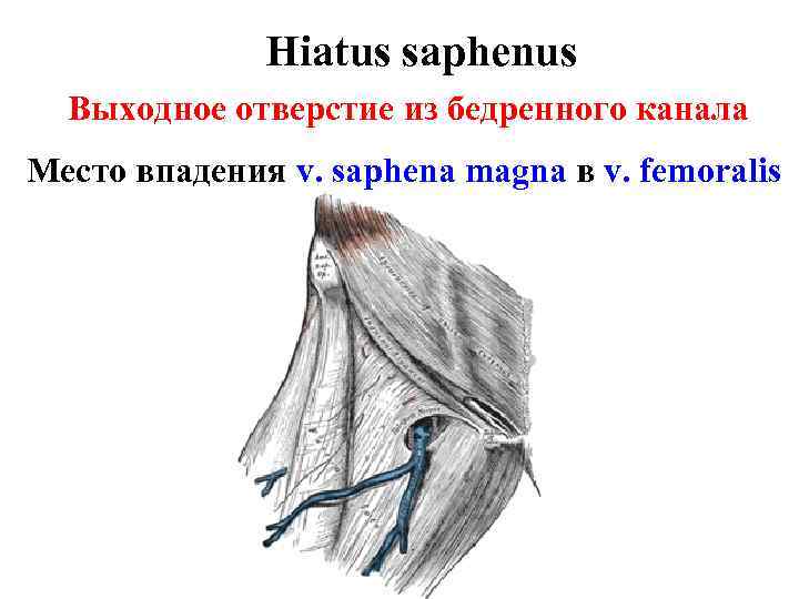 Hiatus saphenus Выходное отверстие из бедренного канала Место впадения v. saphena magna в v.