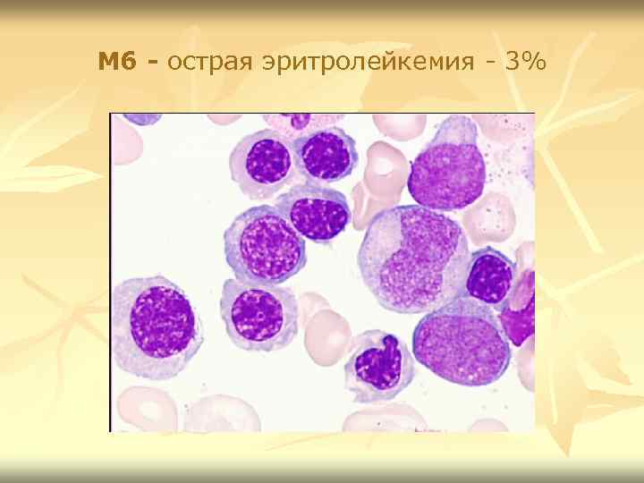 M 6 - острая эритролейкемия - 3% 