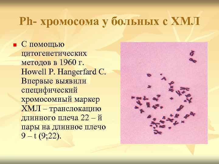 Ph- хромосома у больных с ХМЛ n С помощью цитогенетических методов в 1960 г.