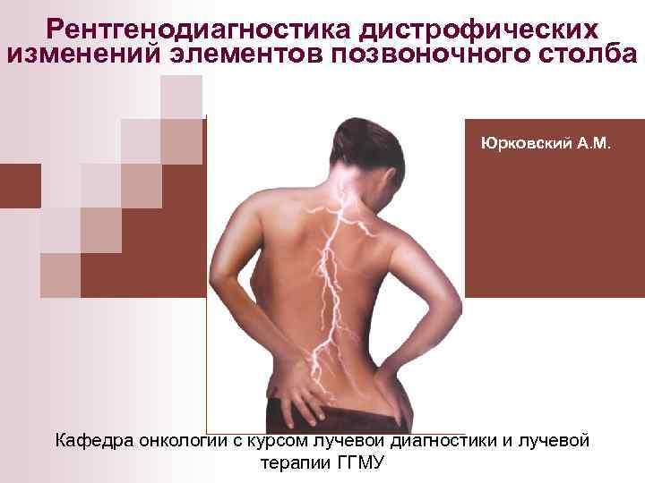 Рентгенодиагностика дистрофических изменений элементов позвоночного столба Юрковский А. М. Кафедра онкологии с курсом лучевой