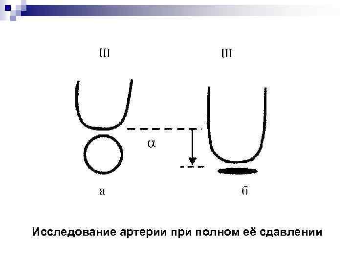 Исследование артерии при полном её сдавлении 