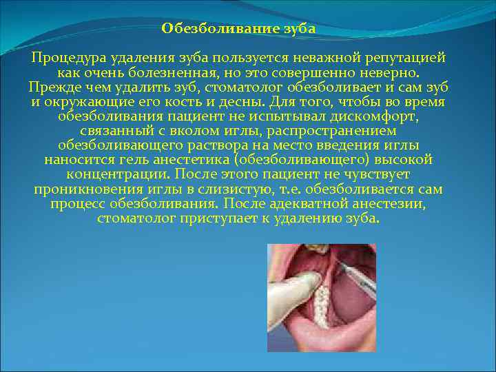 Обезболивание зуба Процедура удаления зуба пользуется неважной репутацией как очень болезненная, но это совершенно