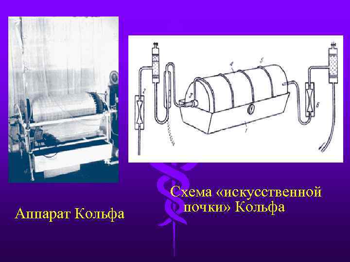 Схема искусственной. Схема «искусственной почки» кольфа.. Аппарат искусственная почка схема. Схема работы искусственной почки. Аппарат для гемодиализа схема.