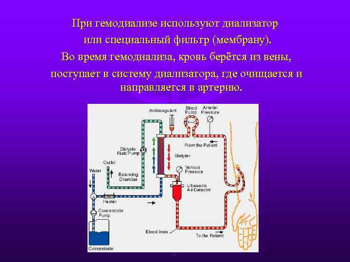 При гемодиализе используют диализатор или специальный фильтр (мембрану). Во время гемодиализа, кровь берётся из