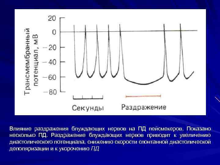 Влияние раздражения блуждающих нервов на ПД пейсмекеров. Показано несколько ПД. Раздражение блуждающих нервов приводит