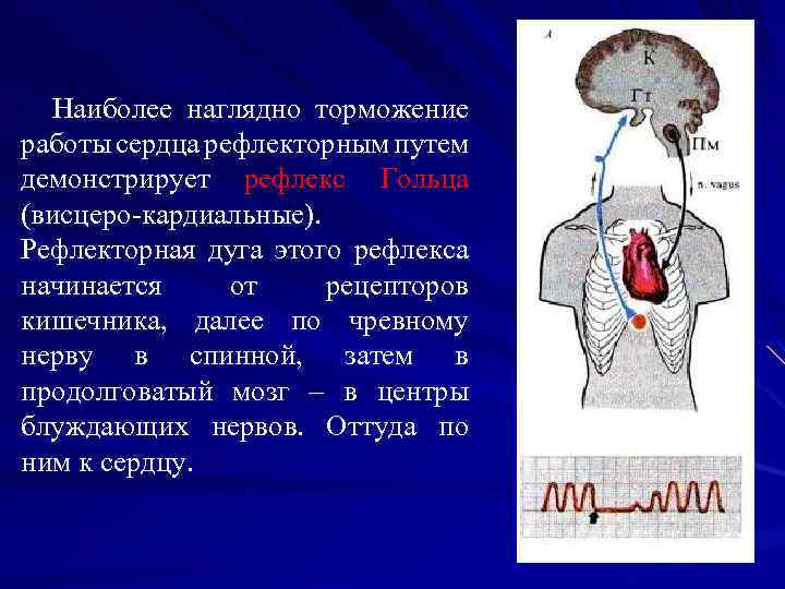 Рефлекс гольца схема рефлекторной дуги