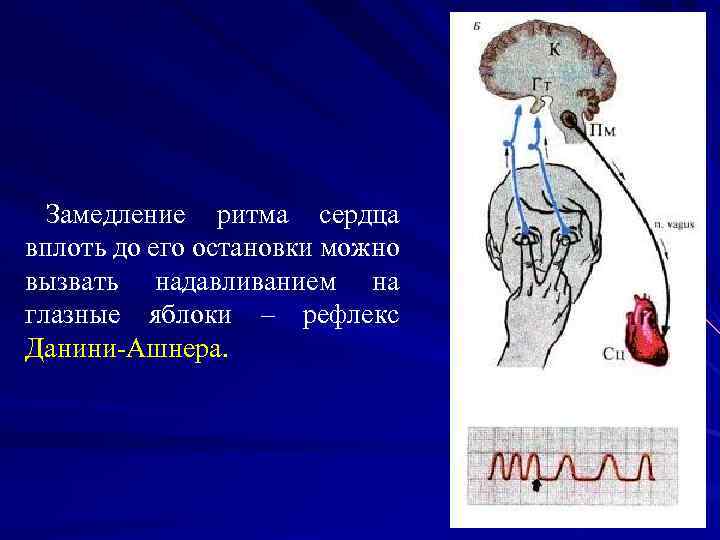 Глазосердечный рефлекс схема