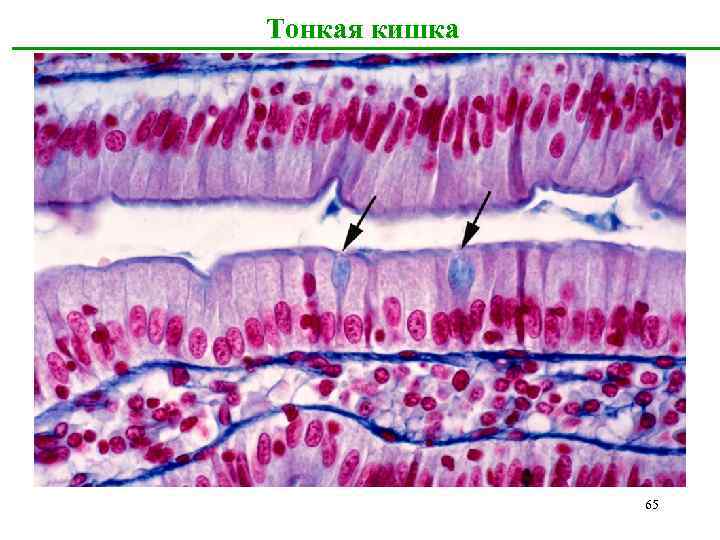 Тонкая кишка 65 