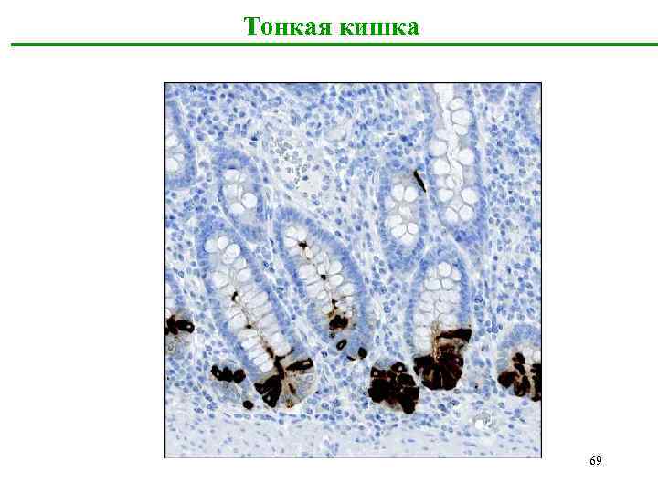 Тонкая кишка 69 