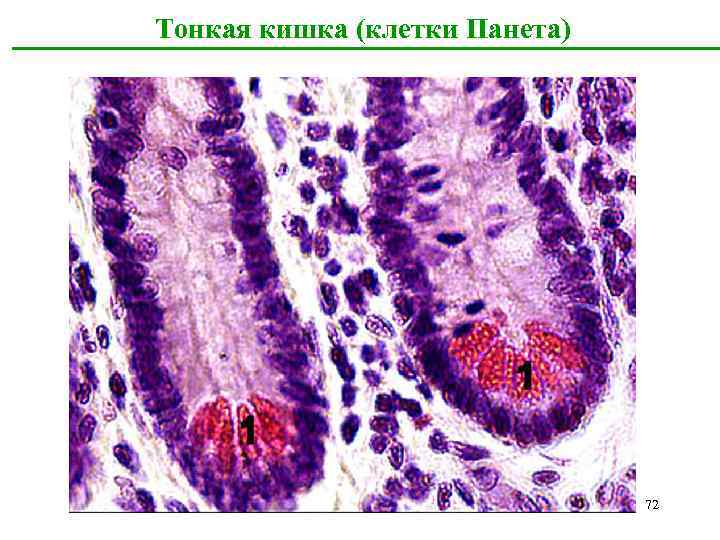 Тонкая кишка (клетки Панета) 72 