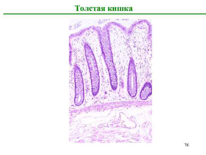 Толстая кишка 76 