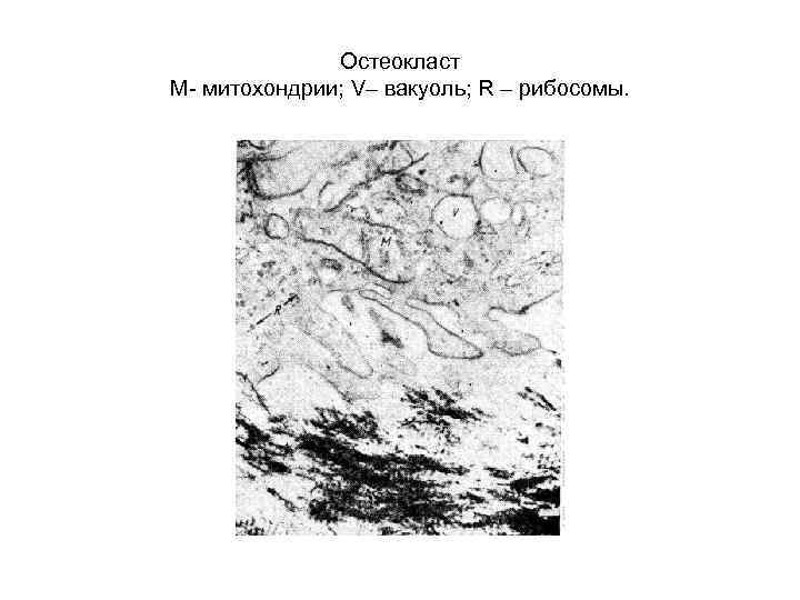 Остеокласт М- митохондрии; V– вакуоль; R – рибосомы. 