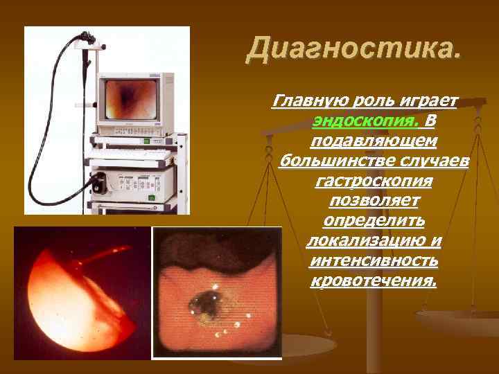 Диагностика. Главную роль играет эндоскопия. В подавляющем большинстве случаев гастроскопия позволяет определить локализацию и
